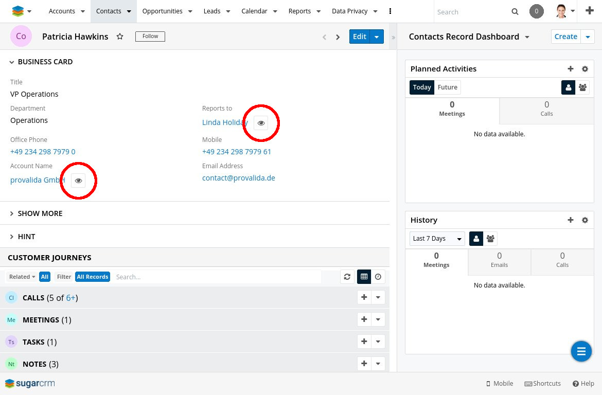 pvView displayed on record view in SugarCRM